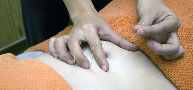 Acupuncture treatment